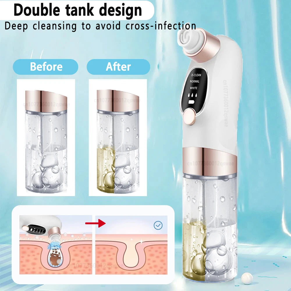 Velari™ Deep Pore Blackhead Remover