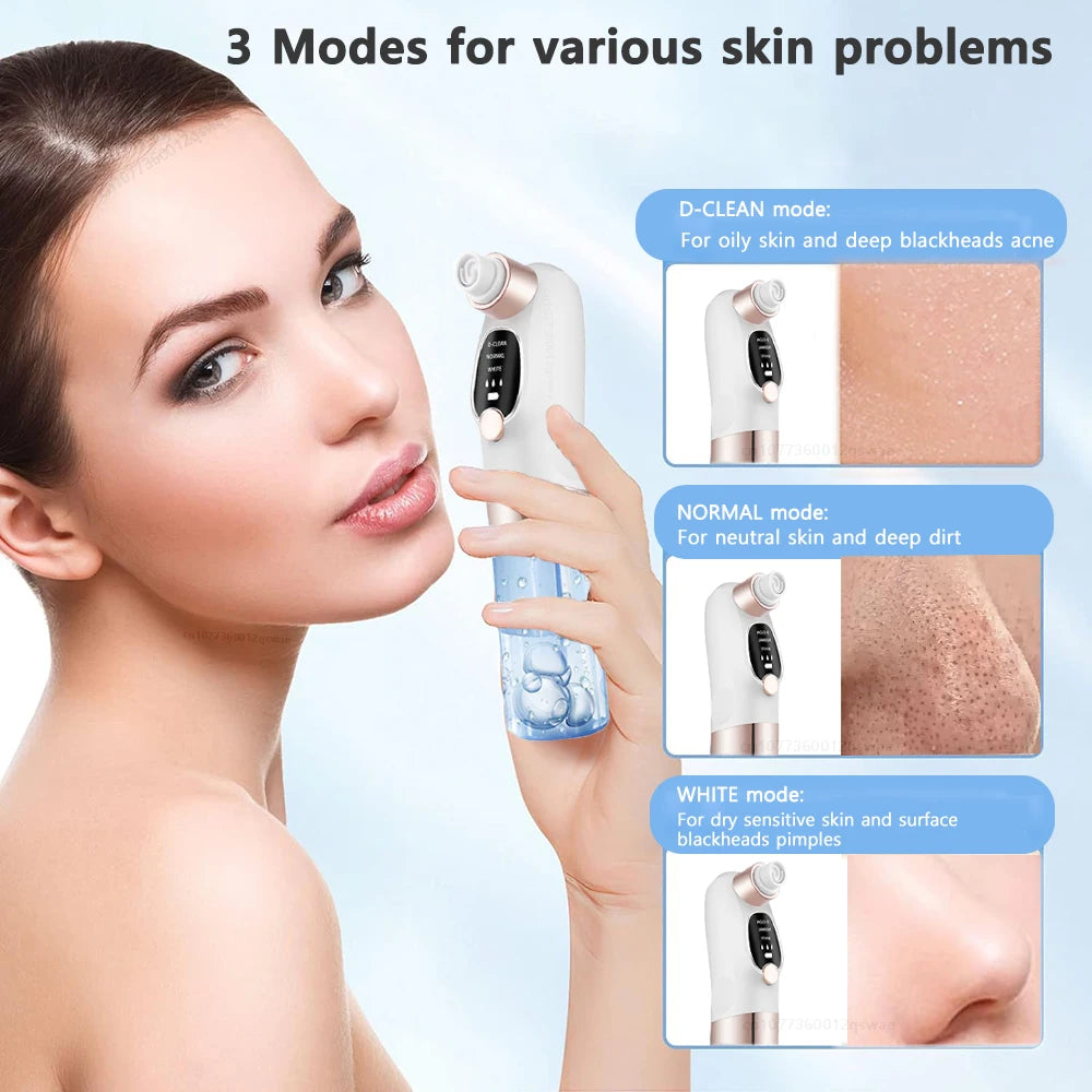 Velari™ Deep Pore Blackhead Remover