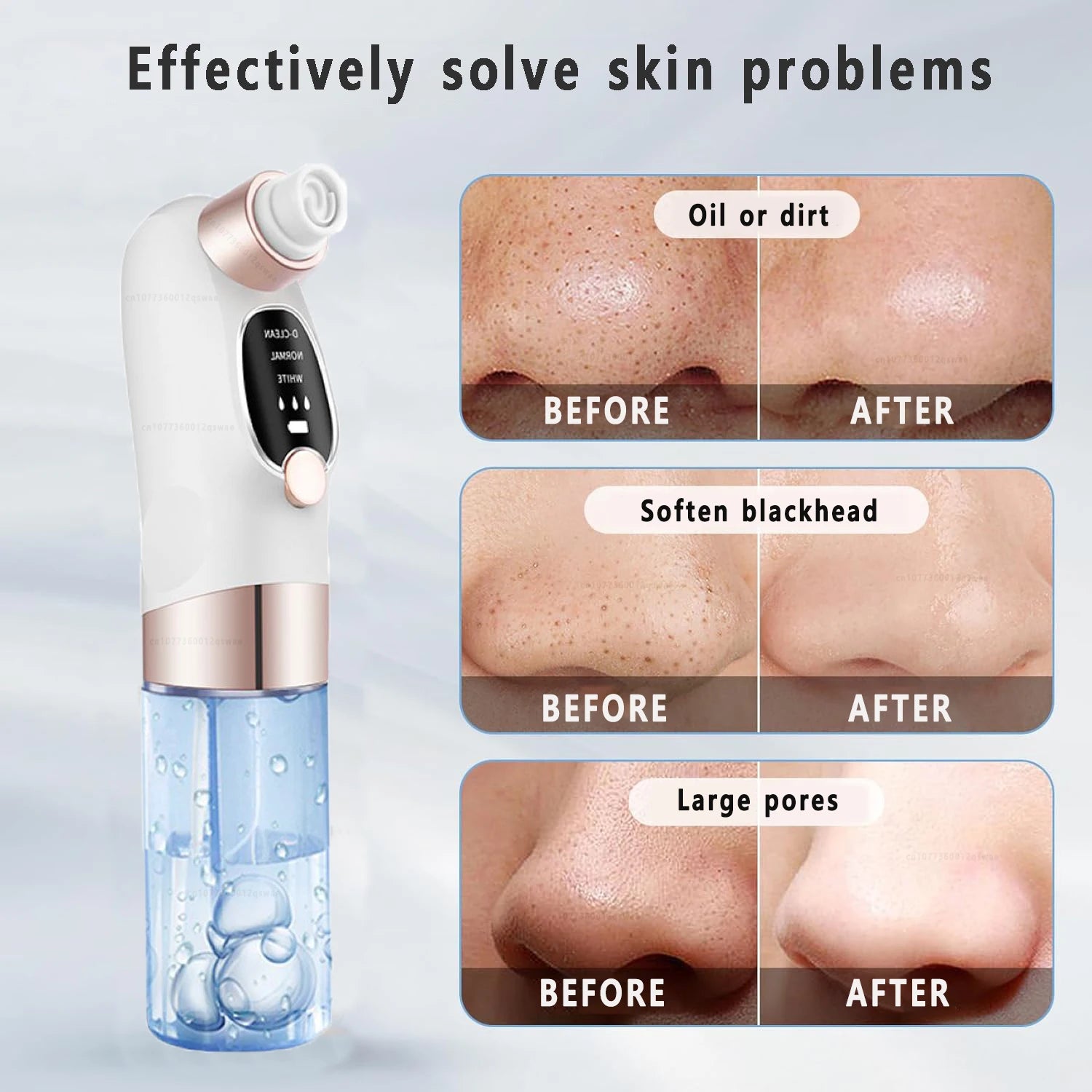 Velari™ Deep Pore Blackhead Remover