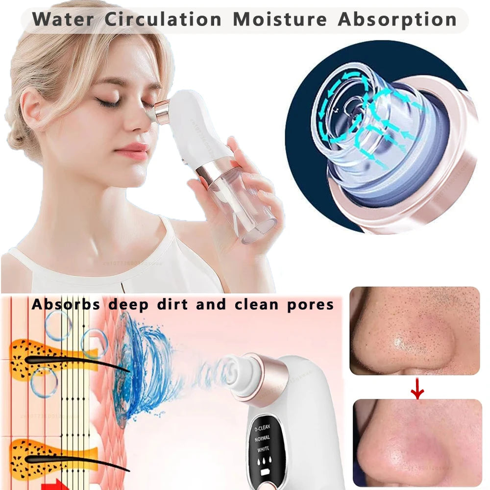 Velari™ Deep Pore Blackhead Remover